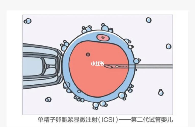 国内试管代怀好不好(国内试管代怀:好不好?)